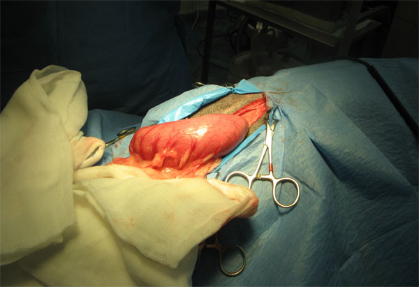 case 12