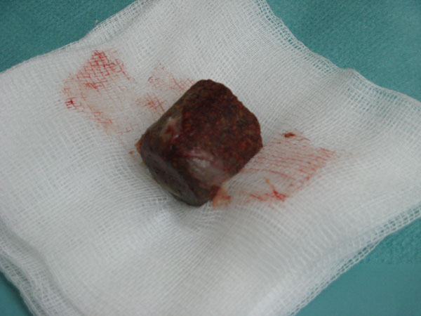 case 8 1
